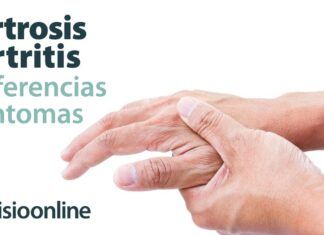 Tipos de Reumatismo: Qué es, Tipos, Síntomas y Tratamientos